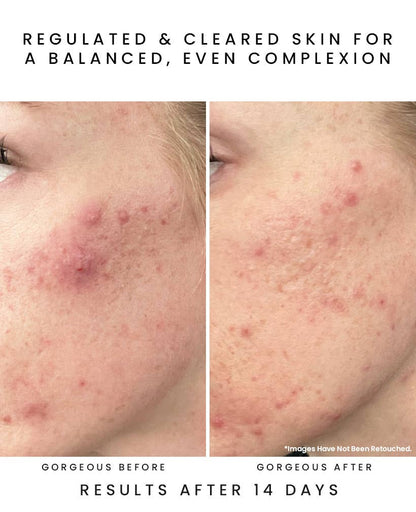 GLOW JUICE 10-Acid Refining Peel: Fruit AHA/BHA : 1 oz